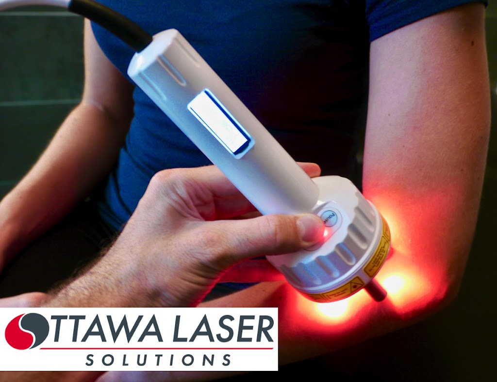 Ottawa Laser Solutions - NEPEAN | Physiocare Physiotherapy, 289 Greenbank Rd, Nepean, ON K2H 8K9, Canada | Phone: (613) 714-9495