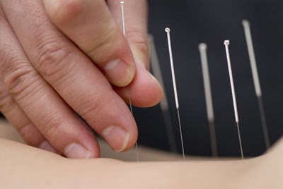 Clayton Heights In-Balance Acupuncture Clinic - ICBC Coverage | Clayton Heights Physiotherapy & Sports Clinic, 18730, Fraser Hwy #206, Surrey, BC V3S 7Y4, Canada | Phone: (778) 317-6026