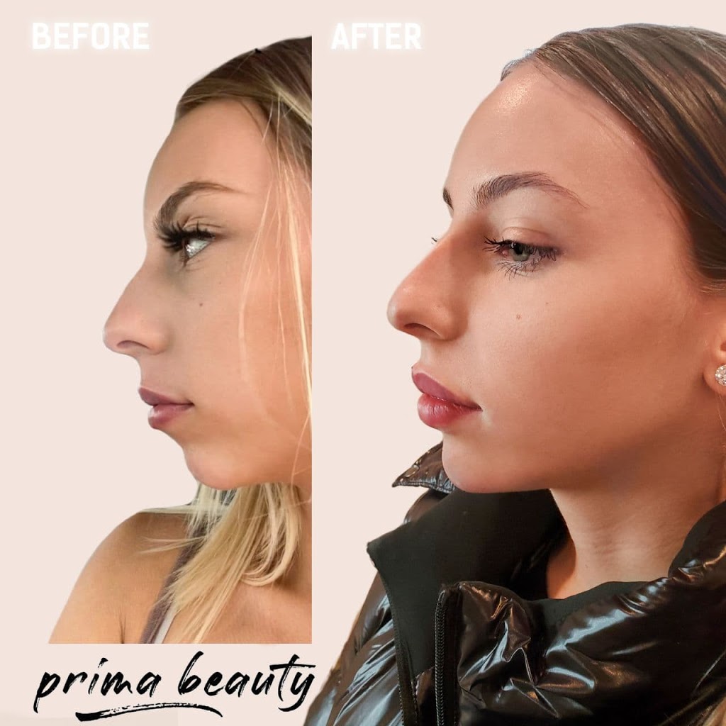 Prima Beauty Aesthetics | 4284 Owl Valley Dr, Gloucester, ON K1V 1L8, Canada | Phone: (613) 709-6477