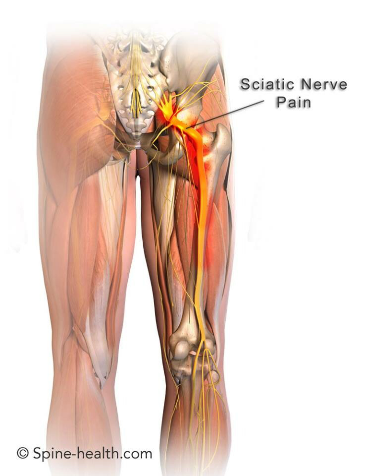 Ottawa Spinal Decompression Center | 2057 Meadowbrook Rd, Gloucester, ON K1B 4W7, Canada | Phone: (888) 456-0454