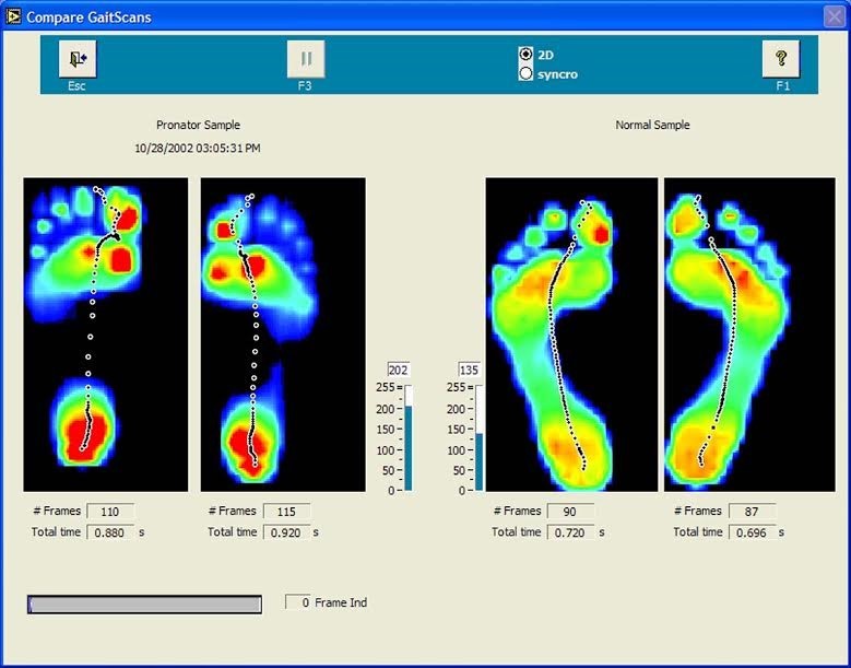 Toronto Orthotics Foot, Leg and Back Pain Clinic (North Toronto) | 3391 Bathurst St Suite A, North York, ON M6A 2B8, Canada | Phone: (647) 444-4909