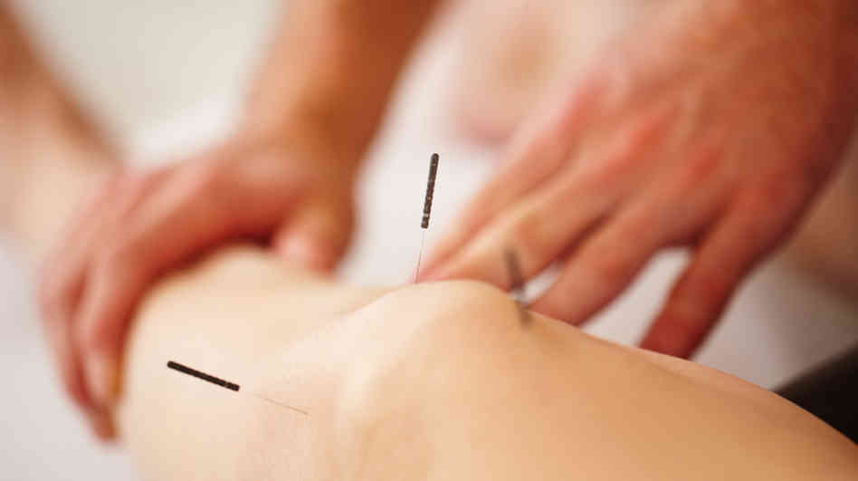 AJM Acupuncture | 11812 St Albert Trail NW, Edmonton, AB T5L 4G4, Canada | Phone: (780) 488-2789