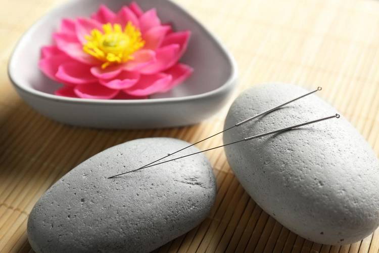 Acupuncture Maca | 3180 Chem. de Chambly #305, Longueuil, QC J4L 1N6, Canada | Phone: (450) 693-0796