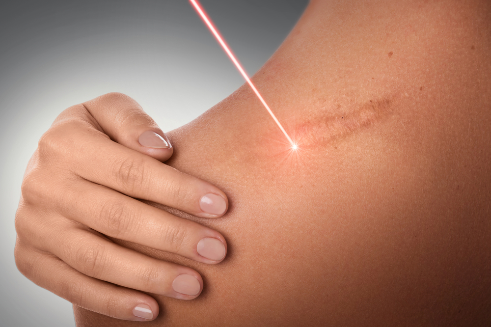 Fairview Laser Clinic Inc. | 701 Sheppard Ave E Suite 317, Toronto, ON M2K 2Z3, Canada | Phone: (416) 495-8547