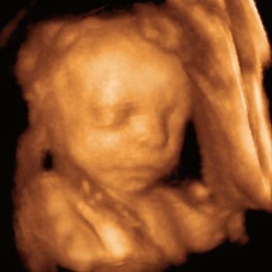 UC Baby 3D Ultrasound | 25 Watline Ave #21, Mississauga, ON L4Z 2Z1, Canada | Phone: (905) 615-0173