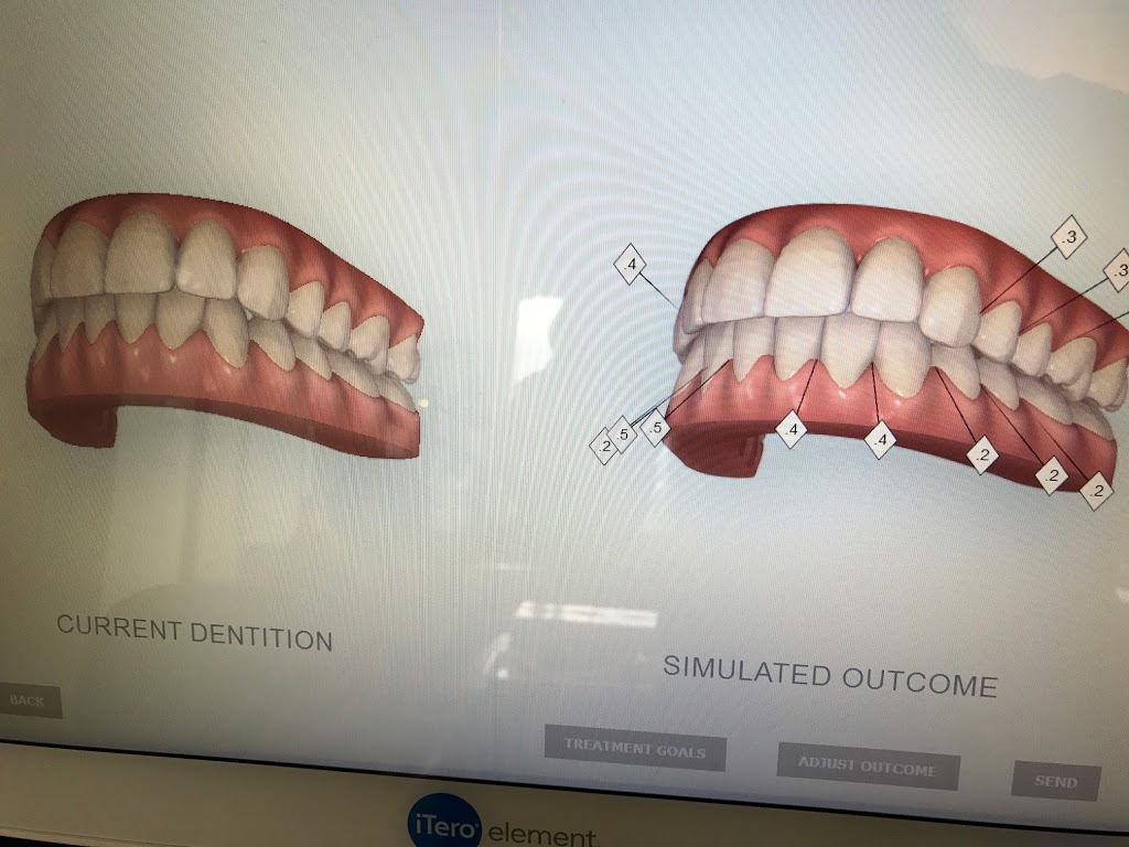 My Family Orthodontist | 800 Yankee Valley Blvd SW, #301, Airdrie, AB T4B 2X3, Canada | Phone: (403) 980-7676