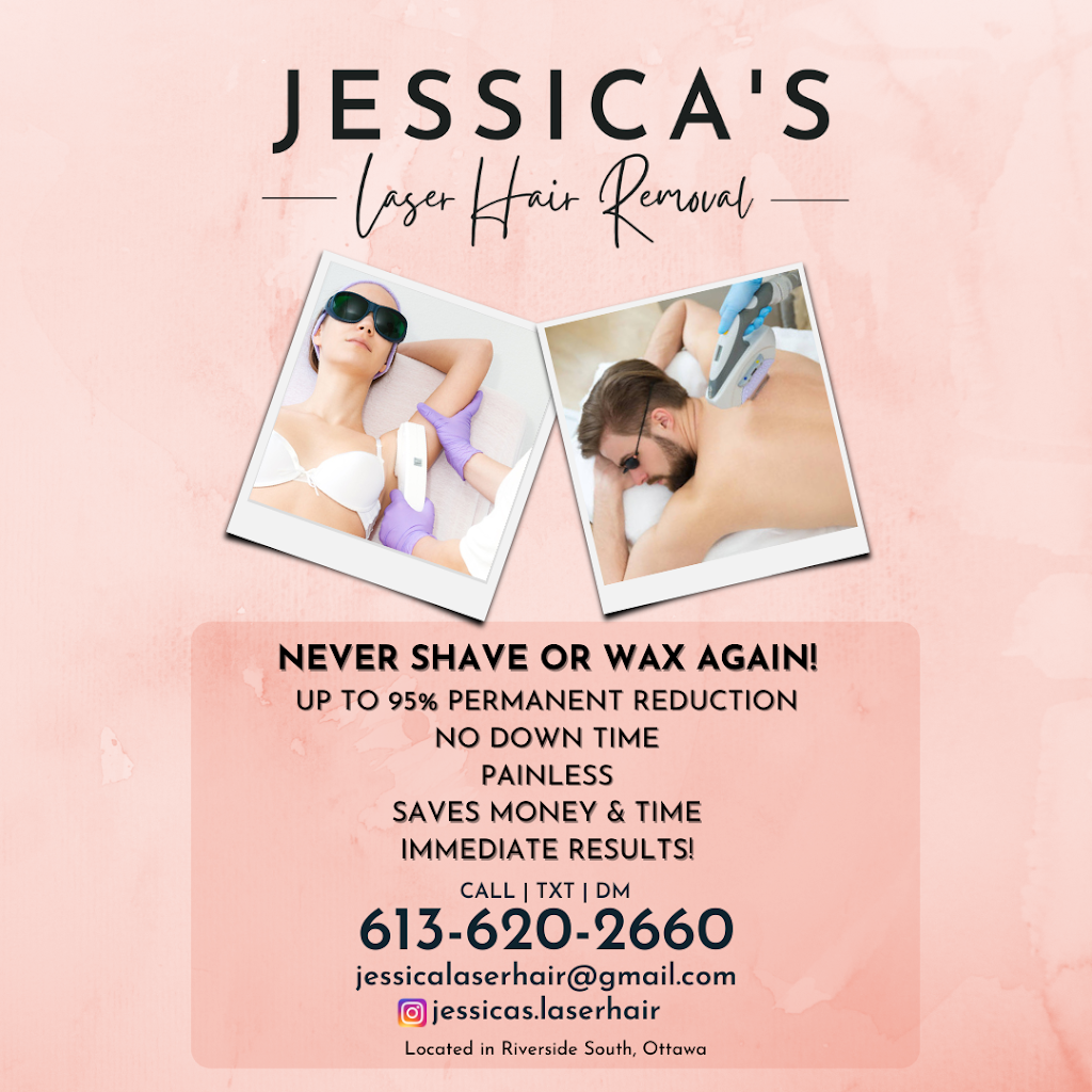 Jessicas Laser Hair Removal | 658 Bowercrest Crescent, Gloucester, ON K1V 2L6, Canada | Phone: (613) 620-2660