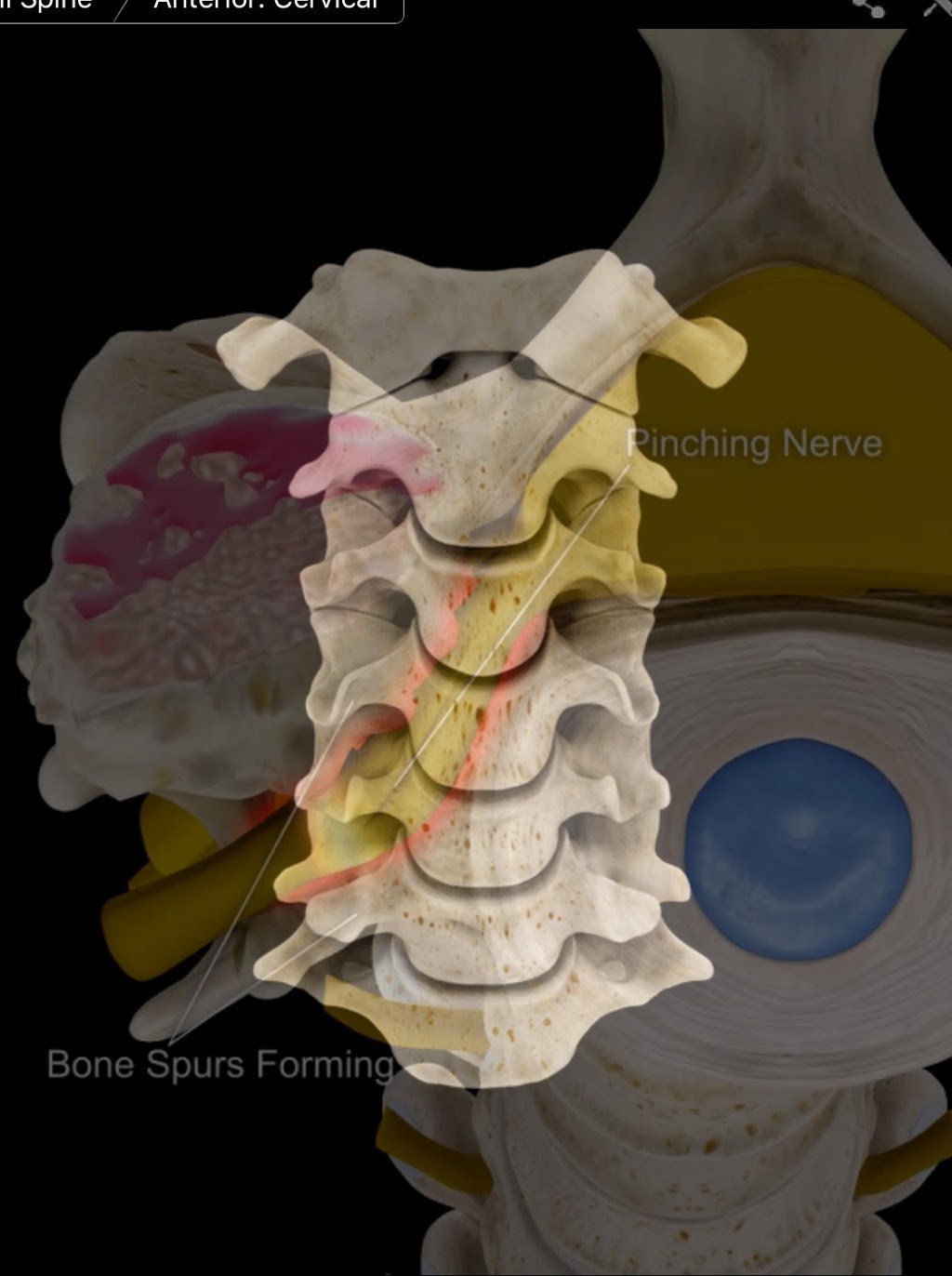 Pain Management Centre - North American Spine Institute | 28 Finch Ave W #212, North York, ON M2N 2G7, Canada | Phone: (647) 991-7246