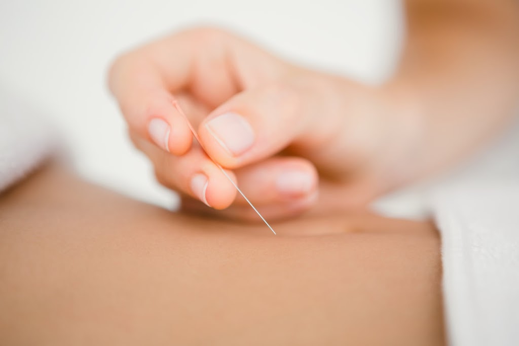 Mario Bissonnette Acupuncture | 255 Rue le Baron, Boucherville, QC J4B 2E4, Canada | Phone: (438) 882-8798