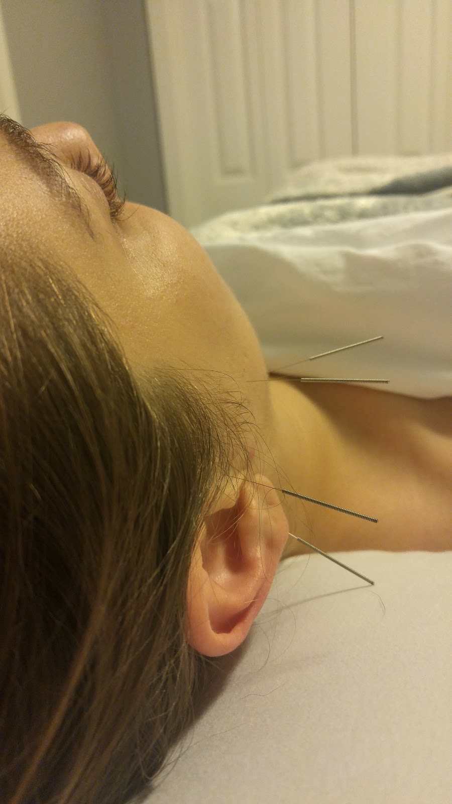 AcuFunkture - Registered Acupuncture in Nanaimo | 4488 Wellington Rd #2b, Nanaimo, BC V9S 5W8, Canada | Phone: (236) 238-1806