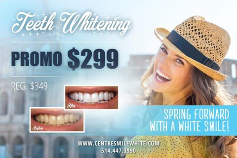 Centre Smile White | 2375 Route Transcanadienne, Pointe-Claire, QC H9R 5Z5, Canada | Phone: (514) 447-3990